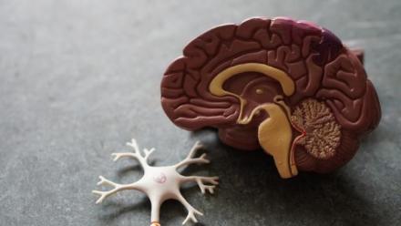 Dementia in Aging Populations: How can Health Claims Data Help Meet this Challenge